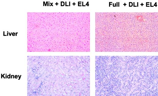 Fig. 3. Absence of leukemic organ infiltration or GVHD in mixed chimeras receiving DLI and EL4. / Histologic analysis of mixed chimeras and full chimeras receiving DLI and EL4 was performed on animals that had succumbed to EL4 leukemia or on animals killed at the end of the observation period. On necropsy, overt infiltration of liver and kidney by leukemic cells was evident in full chimeras receiving DLI and EL4. In contrast, mixed chimeras receiving DLI and EL4 were killed on day 169 after BMT and showed no tumor cell infiltration. Histologic sections from 2 representative chimeras are presented. Liver and kidney from a full chimera receiving DLI and EL4 showed severe infiltration with leukemic cells. In contrast, mixed chimeras receiving DLI showed normal tissue morphology.