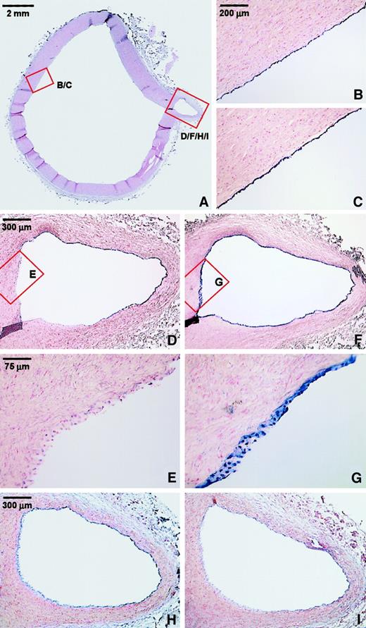 Fig. 5. Endothelial-specific expression of LKLF and claudin-5 in the normal human aorta. / (A) Overview of a section of the thoracic aorta of a 13-year-old female stained with nuclear fast red. Nonradioactive mRNA in situ hybridizations was performed on consecutive sections, using antisense riboprobes of LKLF (B,D,E), claudin-5 (H), cytochrome P450 1B1 (I), and the endothelial-specific marker von Willebrand factor (VWF) (C,F,G). The detection of the mRNA-probe hybrid results in a blue color associated with the nuclei. Panels E and G show no significant expression of the LKLF mRNA (E), whereas VWF (G) is consistently and specifically expressed in the endothelium of the entire specimen. Stacks of nuclei are visible because of the thickness of the sections (16 μm) and the conical shape of the branching artery. Claudin-5 was specifically expressed in the endothelium (H), but detection of the cytochrome P450 1B1 mRNA was too close to background hybridization levels (I).