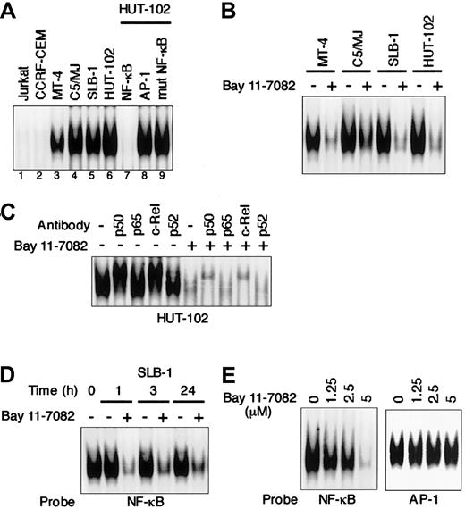 Fig. 1. Specific inhibition of constitutive NF-κB activity in HTLV-I–infected T-cell lines treated with Bay 11-7082. / (A) Nuclear proteins extracted from cultures of T-cell lines were examined for DNA binding by EMSA with a radiolabeled NF-κB–specific probe. All HTLV-I–infected T-cell lines (lanes 3-6) exhibited protein/DNA binding with complex formation, compared with uninfected negative control cell lines (lanes 1 and 2). Cold competition using 100-fold excess of unlabeled NF-κB, AP-1, or mutated NF-κB oligonucleotides demonstrated the specificity of the protein/DNA binding complex (lanes 7-9). (B) Inhibition of constitutive NF-κB activity in HTLV-I–infected T-cell lines. HTLV-I–infected T-cell lines placed in culture at 1 × 106 cells/mL were treated for 1 hour with 5 μM Bay 11-7082 and assessed for NF-κB binding. Additional studies in which each cell line was analyzed for up to 24 hours after treatment yielded the same results. (C) NF-κB subunit specificity was determined by using antibodies to the NF-κB components p50, p65, c-Rel, and p52, resulting in supershift. (D) Time course of NF-κB inhibition in SLB-1 cells treated with Bay 11-7082. SLB-1 cells were treated with 5 μM Bay 11-7082. After the indicated times, nuclear proteins were extracted and EMSA was performed. (E) Specific inhibition of NF-κB by Bay 11-7082. SLB-1 cells were treated with the indicated concentrations of Bay 11-7082. After 1 hour, nuclear proteins were extracted and EMSA was performed with NF-κB– or AP-1–specific radiolabeled oligonucleotide probes. The specificity of the NF-κB inhibition was maintained throughout the 24-hour assay in SLB-1 cells.