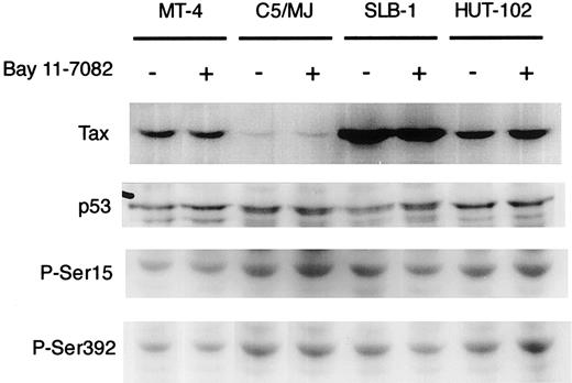 Fig. 4. Effect of Bay 11-7082 on the expression of Tax and the expression and phosphorylation of p53 in HTLV-I–infected T-cell lines. / HTLV-I–infected T-cell lines were treated with 5 μM Bay 11-7082 for 48 hours and assessed by immunoblot for Tax and p53. Phosphospecific antibodies to P-Ser15 and P-Ser392 were used in the detection of phosphorylated residues of p53.