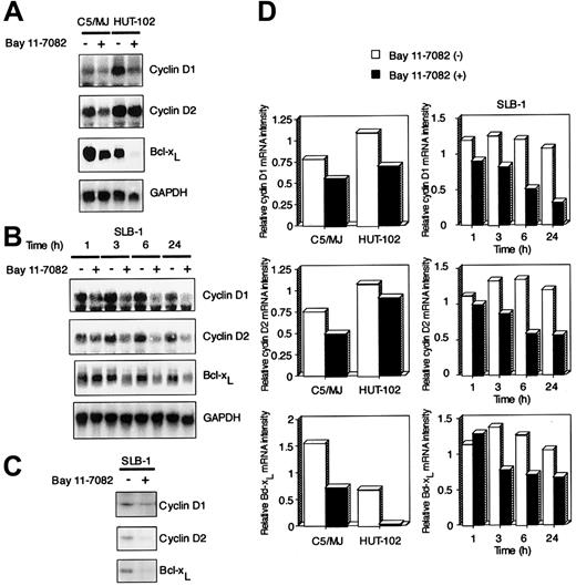 Fig. 5. Effect of Bay 11-7082 on the expression of cyclin D1, cyclin D2, and Bcl-xL in HTLV-I–infected T-cell lines. / (A) Total RNA (20 μg) was extracted from HTLV-I–infected T-cell lines following treatment without or with 5 μM Bay 11-7082 for 24 hours. Northern blot analysis was performed with cyclin D1, cyclin D2, and Bcl-xL cDNA probes. The GAPDH probe was used to demonstrate equivalent RNA levels in each sample. (B) Time course of cyclin D1, cyclin D2, and Bcl-xL mRNA expression in SLB-1 cells treated with Bay 11-7082. Total RNA (20 μg) was extracted from SLB-1 cells following treatment without or with Bay 11-7082 for the indicated times. (C) Expression of cyclin D1, cyclin D2, and Bcl-xL at the protein level in SLB-1 cells. SLB-1 cells were treated without or with Bay 11-7082 for 48 hours. After treatment, the expression of these proteins was examined by Western blot. (D) Graphic quantitation of relative levels of cyclin D1, cyclin D2, and Bcl-xL mRNA expression in cells. GAPDH bands were measured by densitometry and the values were used to normalize for densitometric quantitations of cyclin D1, cyclin D2, and Bcl-xL.