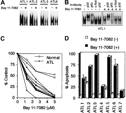 Fig. 6. Bay 11-7082 reduces cell growth and induces apoptosis of primary ATL cells. / ATL cells were cultured at 1 × 106 cells/mL without or with 5 μM Bay 11-7082 for 48 hours. (A) Effect of Bay 11-7082 in ATL cells on the activation of NF-κB assessed by EMSA with NF-κB probe. (B) NF-κB subunit specificity was determined by using antibodies to the NF-κB components p50, p65, c-Rel, and p52, resulting in supershift. (C) ATL cell growth was assessed by the WST-1 method. (D) Induction of apoptosis of ATL cells following inhibition of NF-κB. Data represent the mean ± SD percentages of apoptotic cells from 3 independent experiments for both untreated cells (open bars) and cells treated with 5 μM Bay 11-7082 (solid bars).