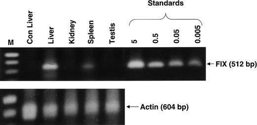 Fig. 6. Detection of rAAV CAGG-FIX transgene in extrahepatic tissue. / Genomic DNA was extracted from liver, kidney, spleen, and testis tissue from one macaque (monkey 3) 9 months after liver-targeted delivery of rAAV in 2 fractionated doses and from the liver of a naive macaque (Con). Then, 1 μg genomic DNA was used for PCR amplification employing transgene-specific primers designed to amplify a 521-bp product. Proviral copy number was deduced from standards that consisted of serial dilutions of vector DNA (5 × 10−3 to 5 copies) in 1 μg control genomic DNA. The integrity of DNA was determined by amplifying a 604-bp region of the rhesus β-gene and is shown at the bottom of the panel.