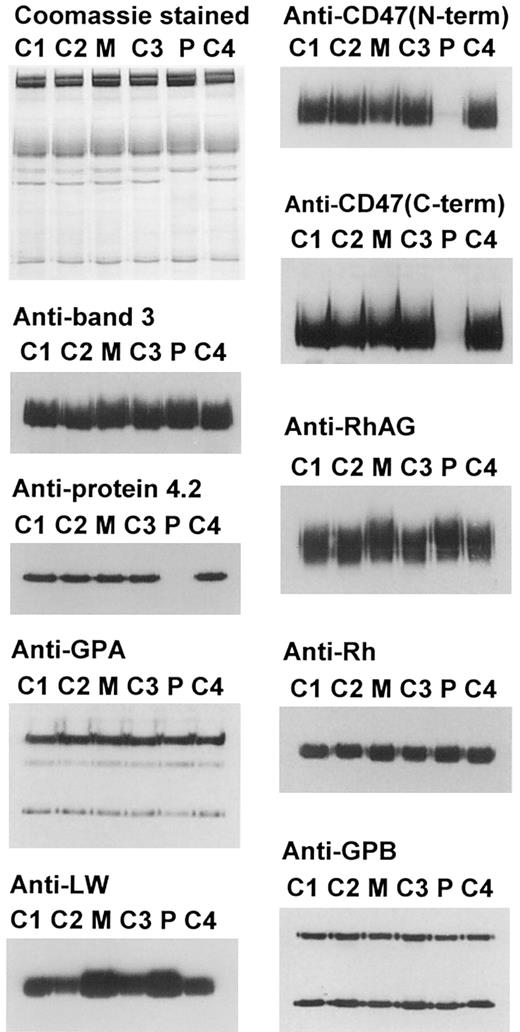 Fig. 1. Electrophoretic and immunostaining of the proteins of the band 3 complex and of the Rh complex. / Erythrocyte ghost membranes were separated on 8% or 10% Laemmli gels. Loading: C1, C2, C3, C4, controls 1-4; M, mother; P, proband. Immunoblotting used polyclonal antibodies against protein 4.2, C-terminal region of CD47 and Rh polypeptides, and monoclonal antibodies: BRIC 170 (band 3), BRIC 163 (GPA), BRIC 125 (N-terminal region of CD47), LA1818 (RhAG), BS56 (LW), and R1.3 (GPB).