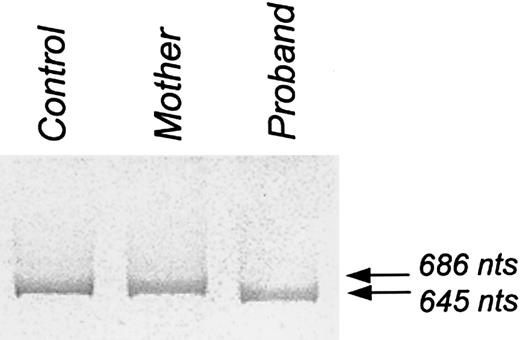 Fig. 3. PCR product of a region of protein 4.2 cDNA encompassing exon 11. / PCR of a region of protein 4.2 cNDA encompassing exon 11 (nucleotides 1111-1797; numbered according to Sung et al2) produced a single band of 686 nucleotides from the control and a single band of 645 nucleotides from the proband. Unexpectedly, PCR of this region from the mother showed only a single band of 686 nucleotides.