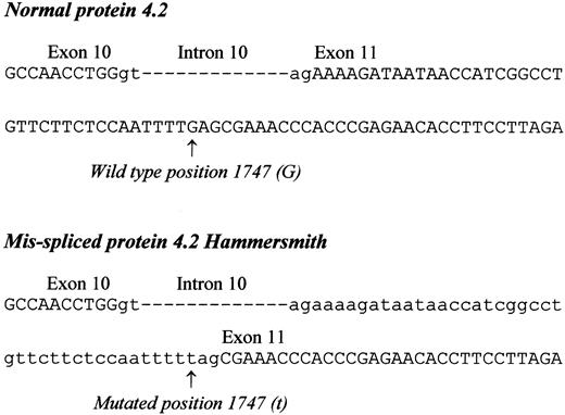 Fig. 4. Genomic mutation (1747G>T) in the proband and the cryptic acceptor splice site. / Normal protein 4.2 genomic DNA sequence is shown between nucleotides 1699-1779 (using cDNA numbered according to Sung et al2), also shown are the “gt” donor and “ag” acceptor sites of intron 10. The equivalent sequence in protein 4.2 Hammersmith shows the cryptic acceptor splice site (nucleotides 1748-1749) activated by the mutation. Wild-type (G) and mutated (t) position 1747 are marked with an arrow. Note that in protein 4.2 Hammersmith the normal “ag” acceptor site of intron 10 is present.