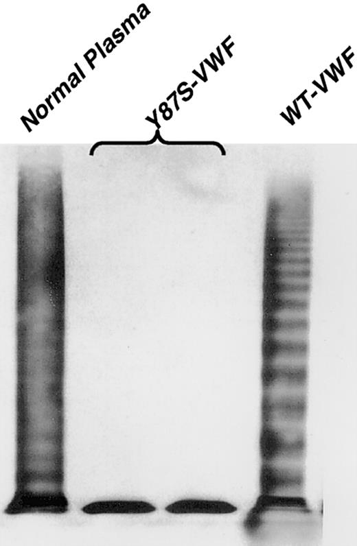 Fig. 3. Multimeric composition of expressed mutant VWF. / The Tyr87Ser-VWF and WT-VWF plasmid constructs were transiently expressed in COS-7 cells, and the expressed proteins analyzed on 1.5% agarose-SDS gels (see “Materials and methods”). The type of VWF plasmid transfected is listed above the lanes, with normal plasma run for comparison purposes (lane 1). Two separate transfections of Tyr87Ser-VWF plasmids in COS-7 cells have been analyzed on this Western blot (lanes 2 and 3). Compared with the WT-VWF (lane 4), there is clearly a lack of multimerization by the Tyr87Ser (lanes 2 and 3) VWF defect, and only dimers are visualized.