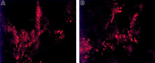 Fig. 4. Intracellular storage of dimeric VWF in granules. / Intracellular storage of dimeric VWF in granules is similar to that of wild-type VWF. Indirect immunofluorescence detection of VWF storage granules in stably transfected AtT-20 cells demonstrates the vesicular storage of dimeric VWF. AtT-20 cells were stably transfected with WT-VWF (panel A) or Tyr87Ser-VWF (panel B). The fixed and permeabilized cells were immunolabeled as described in “Materials and methods.” All cells shown in this Figure have been labeled with anti-VWF polyclonal antibodies (detected by Texas Red) to visualize the intracellular localization of VWF. Shown are 3-D projections of confocal images taken by confocal laser scanning microscopy (Bio-Rad C600, × 1500 magnification). Dimeric VWF resulting from the Tyr87Ser mutation is stored in Weibel-Palade body–like granules similar to those of WT-VWF storage.