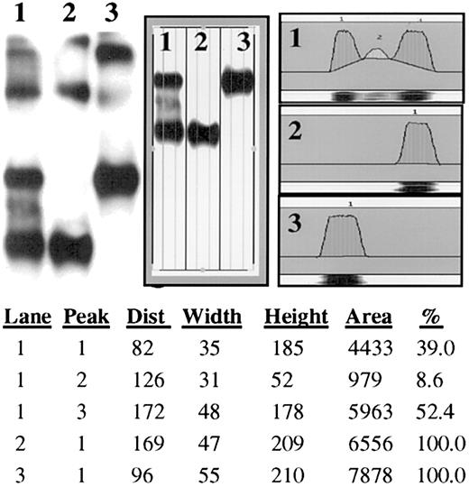 Fig. 6. Facilitation of multimerization. / The propeptide functions in cis and trans to facilitate multimerization. The question of homodimer versus heterodimer formation in VWF biosynthesis was addressed by the coexpression of HPP-VWF (wild-type VWF containing a disrupted furin-cleavage site) with wild-type VWF. When these 2 VWF proteins were coexpressed in HEK293T cells, the resulting protein expression showed nearly exclusive formation of homodimers (lane 1). As a size reference, each single plasmid transfection was included in the gel analysis (WT-VWF, lane 2, and HPP-VWF, lane 3). The immunoblot shown was scanned and the band densities were calculated. Each peak is listed with the scanned area and percentage of total area per gel lane. Only 8.6% of the total VWF detected in lane 1 is heterodimeric. Dimer formation appears to be primarily homodimeric.