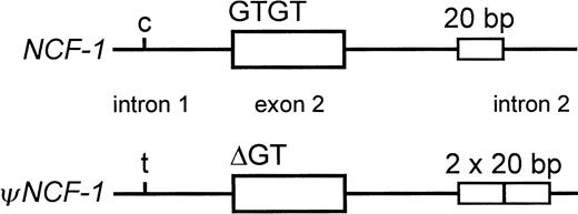 Fig. 1. Differences between NCF-1 and its pseudogenes. / Within a small segment of the gene, the most well-characterized differences between NCF-1 and its pseudogenes(ψNCF-1) are shown. These are a C/T transition in intron 1 at −122 bp from the start of exon 2, GTGT or ΔGT at the beginning of exon 2, and the single or duplicated 20-bp stretch in intron 2 at +176 bp from the end of exon 2.