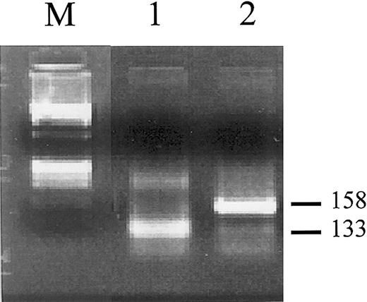 Fig. 1-1. Clonality analysis of leukemic cells obtained from the initial APL phase (lane 1) and subsequently developed AML phase (lane 2) in patient 2.1-1. / RNA was reverse transcribed using random primers and cDNA were amplified with primers specific for the iduronate-2-sulfatase(IDS) gene as described.1-2 Amplified fragments were digested with the methylation-sensitive HpaII restriction endonuclease prior to agarose gel electrophoresis. Two differently sized bands of 133 and 158 bp are visible in lanes 1 and 2, which correspond to distinct allelic methylation patterns. M indicates molecular weight marker (ΦX 174 DNA/BsuRI).