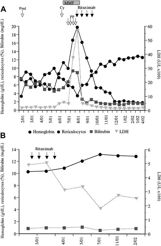 Fig. 1. Changes in biologic variables before and after rituximab therapy. / (A) First patient; (B) second patient. Pred indicates prednisone; PP, plasmapheresis; Cy, cyclophosphamide; and MMF, mycophenolate mofetil.
