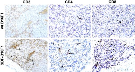 Fig. 6. T cells infiltrate SDF-B16F1 but not wild-type B16F1 tumors. / C57BL/6 mice were injected intradermally with wild-type B16F1 or SDF-B16F1 cells and tissues were collected for histology/immunohistochemistry, as described in “Materials and methods.” Tissue sections from samples collected at day 7 after tumor inoculation are shown here. Immune cell infiltrates (CD3, CD4, and CD8 T cells; arrows) are observed prominently in SDF-tumors, but not in wild-type tumors (original magnification × 10).