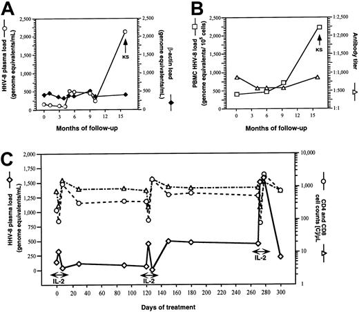Fig. 1. Dynamics of HHV-8 plasma viremia and human DNA plasma contamination, PBMC HHV-8 load and anti–HHV-8 lytic Ab titers, and dynamics of HHV-8 replication and CD4 and CD8 T-cell counts in one IL-2–treated patient in whom KS developed. / (A,B) Plasma load of HHV-8 DNA (○) and β-actin (♦), HHV-8 load of PBMCs (■), and anti–HHV-8 lytic antigens Ab titer (▵), in patient 70. IL-2 was administered subcutaneously every 8 weeks for a total of 6 cycles (5 days twice a day for each cycle). KS lesions developed after 12 months of IL-2 therapy, 5 months after the last administration of IL-2. (C) Dynamics of HHV-8 plasma viremia (⋄) and CD4 (○) and CD8 (▵) T-cell counts during IL-2 therapy in patient 70.