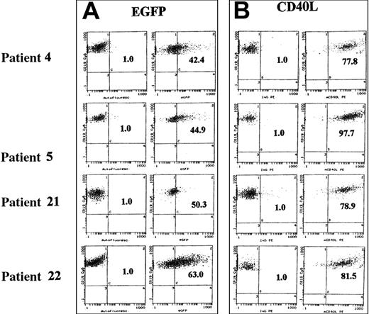 Fig. 2. EGFP and murine CD40L expression after rAAV transduction (MOI 100). / Primary B-CLL cells derived from patients 4, 5, 21, and 22 (Table 1) were transduced at an MOI of 100 with rAAV vectors encoding EGFP (A) and CD40L (B) and analyzed for transgene by flow cytometry 48 hours later. The graphs on the left of each panel (control) represent the autofluorescence (EGFP) and isotype (CD40L) controls, respectively, and the graphs on the right of each panel show the cells transduced with rAAV vectors (AAV/EGFP, AAV/CD40L). Dot-plot analysis of the double staining for the B-cell lineage marker CD19 (Cy5-conjugated mAb; y-axis) and transgene expression (EGFP and PE-conjugated anti–murine CD40L; x-axis) is shown.