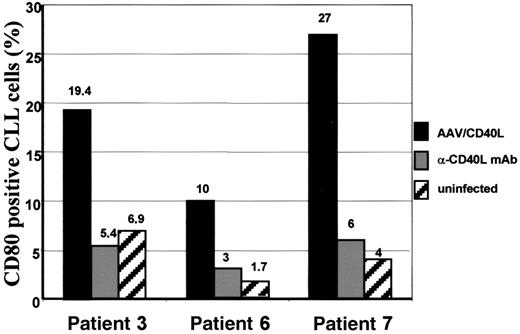 Fig. 5. CD80 expression on B-CLL cells after CD40L transduction. / CD80 expression was assessed in samples derived from patients 3, 6, and 7 after infection with AAV/CD40L (black bars) in comparison to uninfected control CLL cells derived from the same patient (striped bars). Expression of CD80 was also detected after coincubation with specific anti–murine CD40L mAb (gray bars).