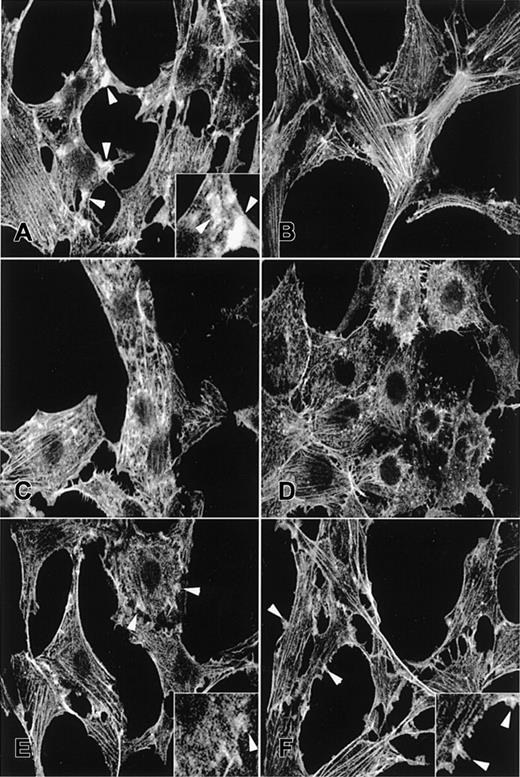 Fig. 3. Fluorescence photomicrographs of TRITC-phalloidin–stained NIH3T3 fibroblasts. / (A-B) EGFP alone, (C-D) Rac2D57N, (E) Rac2D57NΔCT, or (F) Rac2D57NΔM. Panels A, C, E, and F were treated with PDGF; panels B and D, no treatment. Arrowheads point to membrane ruffles. Magnification × 400. Inserts show the membrane ruffles at higher magnification (×800).