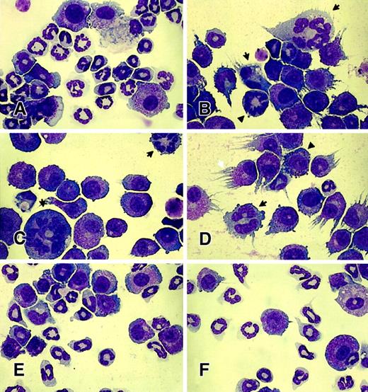 Fig. 4. Effect of expression of mutant Rac proteins on neutrophil differentiation. / Wright-Giemsa staining of retrovirus-transduced mononuclear BM cells after in vitro differentiation: (A) EGFP alone, (B-D) Rac2D57N, (E) Rac2D57NΔCT, or (F) Rac2D57NΔM. Wright-Giemsa stained, magnification × 1000. Note the abnormal cell size, multiple nuclei (arrows in B-D), hypersegmented nuclei (arrowhead in B), intense granules and irregular granulation (black arrowhead in D), and asynchronous nuclear and cytoplasmic maturation (B-D) in Rac2D57N-expressing neutrophils. Also note the marked reduction in the number of mature neutrophils present in Rac2D57N-expressing cells. The white arrow in panel D indicates the cell processes extending in a “streamer” morphology predominantly found in Rac2D57N-expressing cells under the experimental conditions. These photomicrographs are representative of the results obtained from 3 independent experiments.