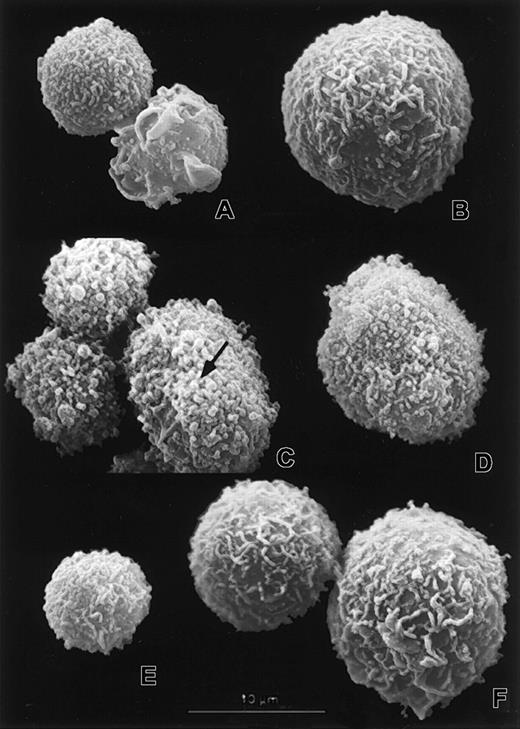 Fig. 5. Scanning electron micrographs showing surface morphology of transduced myeloid cells. / The neutrophils (A,C,E) and large myeloid cells (B,D,F) from vector control (A-B), Rac2D57N (C-D), and Rac2D57NΔM(E-F) cultures were examined by SEM. Note the microvilli and surface folds of varying thickness (A,B,E,F) as well as the abnormal stumpy microvilli and blebs (C-D). The arrow in panel C points to a bleb. Scale bar represents 10 μm in all micrographs.