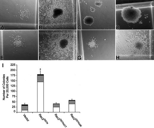 Fig. 7. Colony morphology and colony formation of progenitors from transduced and sorted BM cells. / (A-H) Photomicrographs of small and large GM colonies produced by vector control (A-B), Rac2D57N (C-D), Rac2D57NΔCT (E-F), or Rac2D57NΔM (G-H) progenitors. Magnification × 100. (I) Quantitation of CFU derived from transduced BM cells. Values represent the mean of colony numbers in triplicate cultures. The open, hatched, and black bars denote small, medium, and large size colonies, respectively. The total number of colonies in each genotype was the sum of small, medium, and large colonies. The error bars indicate standard deviations (*P < .004 for comparisons between Rac2D57Nand any other genotype). Data shown are representative of 3 independent experiments.