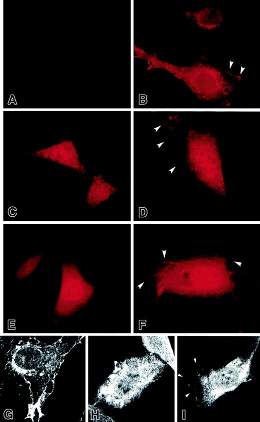 Fig. 8. Immunofluorescence photomicrographs show the localization of Rac proteins in transduced NIH3T3 cells by epifluorescence and confocal microscopy. / Panel A shows vector control; panels B and G, wt Rac2; panel C, Rac2D57NΔCT; panel D, Rac2D57NΔM; panels E and H, Rac2ΔCT; and panels F and I, Rac2ΔMproteins, which were tagged with a Flag epitope at the N-terminus, using the mouse anti-Flag M2 antibody followed by TRITC-conjugated anti–mouse IgG. (A-F) Epifluorescence images, magnification × 1000; (G-I) immunofluorescence images recorded with a confocal microscope, magnification × 600. Arrowheads indicate the proteins localized to the plasma membrane.