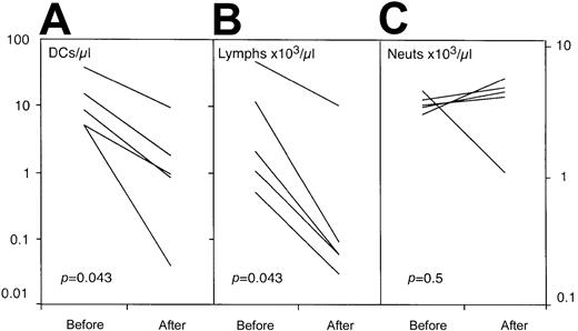 Fig. 4. The effect of alemtuzumab therapy on the number of circulating DCs, lymphocytes, and neutrophils. / The patients had received no therapy other than alemtuzumab and were studied prior to and on day 5 of intravenous treatment at a dose of 20 mg per day (allo-HSCT patients) or 30 mg on alternate days (lymphoproliferative patients). There was a significant reduction in circulating DCs (A) that paralleled the fall in lymphocyte count (B). No change in the number of circulating neutrophils was observed (C).