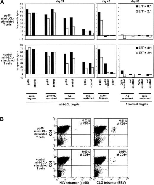 Fig. 3. Properties of pp65 mini-LCL–stimulated and control mini-LCL–stimulated T cells from the CMV−, EBV+ donor no. 1. / (A) The cytotoxic activity of pp65 mini-LCL–stimulated polyclonal T cells (upper row) and control mini-LCL–stimulated T cells (lower row) from donor no. 1 against diverse target cells was assayed by chromium release on days 24, 42, and 55, respectively. (B) Tetramer analysis of the T-cell cultures using a pp65 epitope tetramer (NLV) and an EBV epitope tetramer (CLG), both HLA-A2-restricted, performed on day 35 of culture. E/T indicates effector-target ratio.