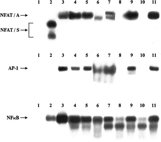 Fig. 4. Activity of the lymphotropic TFs. / Activities of AP-1, NF-κB, and NFAT in nuclear extracts isolated from PBLs of 2 ITP patients in acute phase and in remission and a healthy pediatric control are shown. EMSAs were performed with labeled probes, as described in “Patients, materials, and methods,” and protein extracts from PBLs of the patients and the healthy control before or after mitogenic stimulation of the cells with PMA and ionomycine. Lane 1, free probes; lane 2, healthy control, ex vivo cells; lane 3, healthy control, stimulated cells; lane 4, first patient in acute phase, ex vivo cells; lane 5, first patient in acute phase, stimulated cells; lane 6, second patient in acute phase, ex vivo cells; lane 7: second patient in acute phase, stimulated cells; lane 8, first patient in remission, ex vivo cells; lane 9, first patient in remission, stimulated cells; lane 10, second patient in remission, ex vivo cells; lane 11, second patient in remission, stimulated cells. Arrows show active TF complexes. NFAT-A indicates NFAT-binding activator; NFAT-S, NFAT-binding silencer.