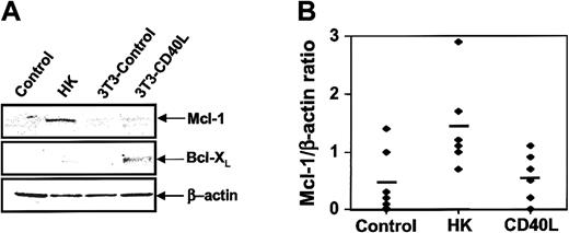 Fig. 3. Effect of HK cells on levels of Mcl-1 in CLL B cells. / (A) CLL B cells from representative patient specimens were cultured for 24 hours alone (“control”); with HK cells; with NIH3T3 control cells; or with NIH3T3-hCD40L cells. CLL B cells were recovered from cultures, and protein-containing lysates were prepared, normalized for total protein content (12.5 μg per lane) and analyzed by SDS-PAGE/immunoblot assay with the use of antibodies specific for Mcl-1, Bcl-XL or β-actin. (B) Mcl-1 and β-actin protein levels were assayed by SDS-PAGE and immunoblotted as above for 6 CLL B-cell samples. Data were quantified by scanning densitometry and expressed as a ratio (n = 6).