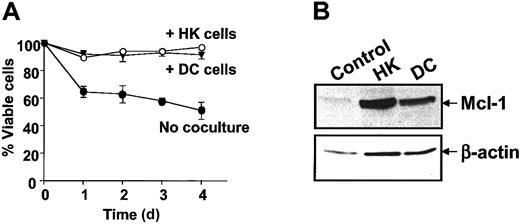 Fig. 4. Effect of dendritic cells on CLL B-cell apoptosis and Mcl-1 expression. / (A) CLL B cells were cultured alone or together with either HK or normal dendritic cells. Apoptosis was measured by annexin V–FITC/PI double staining by means of flow cytometric analysis at various times after initiation of culture (n = 5). (B) Protein lysates were prepared after 24 hours and analyzed by SDS-PAGE/immunoblot assay with the use of antibodies specific for Mcl-1 and β-actin.
