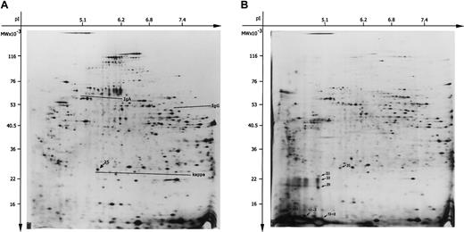 Fig. 3. The 2-DE of the soluble and membrane-bound protein fractions from the patient's liver sample. / Proteins (100 μg) were separated in the first dimension by IEF using carrier ampholytes pH 3 to 10. Separation in the second dimension was performed using an acrylamide gradient (10%-16%) followed by silver staining. The relative molecular mass (Mr) axis was calibrated by standard proteins (Protein Mr Marker Kit, Pierce). (A) The 2-DE pattern of soluble protein fraction. The areas of IgA and IgG heavy chains as well as κ light chain are underlined, spot 25 (25 kDa/pI 5.6) is marked by arrow. (B) The 2-DE pattern of the membrane-bound protein fraction. The spots chosen for mass spectrometry were marked by arrows (spots: 25, 23, 22, 20, 13-1, 13-2, and 13-3). Unit for the x-axis is pI; y-axis, MW (molecular weight; kDa).