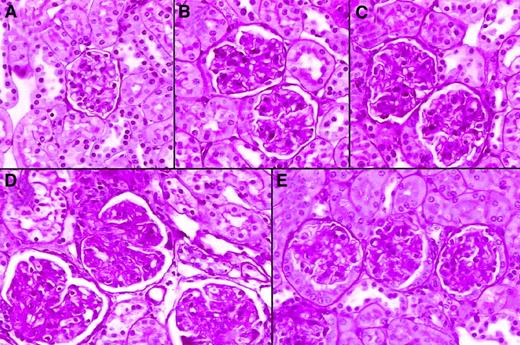 Fig. 3. Representative histological appearance of glomerular lesions of kidneys from 48-week-old chimeric mice. / BALB/c (panel A); BALB/c→BXSB (panel B); BALB/c+BXSB→ BXSB (panel C); BXSB→BXSB (panel D); BALB/c+BXSB→BALB/c (panel E). Note the marked difference in the size and the mesangial-glomerular cellularities of glomeruli between syngeneic chimeras and mixed chimeras. The tissues were stained with PAS reagent (original magnification, × 100).
