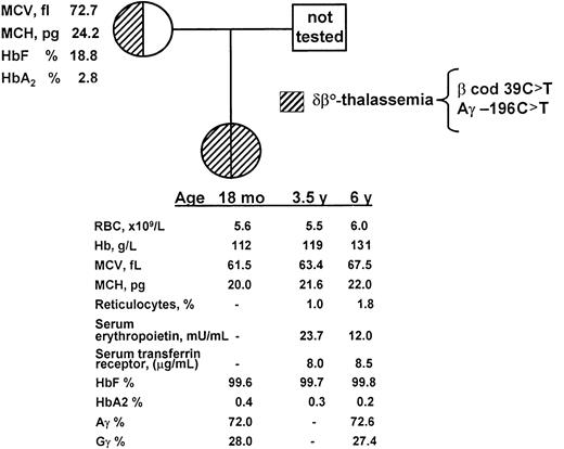 Fig. 1. Nondeletion δ-β homozygous state. / Pedigree of the family and principal hematologic data.