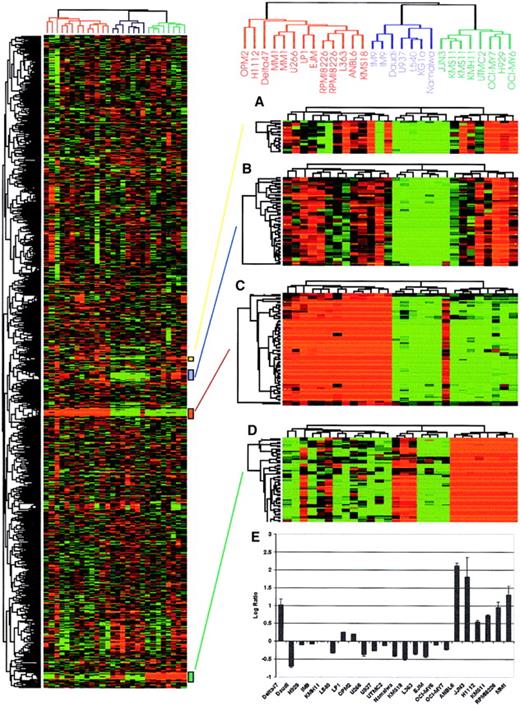 Fig. 4. Hierarchical cluster analysis of myeloma cell lines. / Total RNA from myeloma and nonmyeloma cell lines (5 lymphoma and 1 leukemia) were labeled with Cy5 and hybridized to our 4300 myeloma cDNA microarray together with a Cy3-labeled standard reference pool. All the data were mean centered and clustered using a Pearson correlation coefficient as a similarity metric and average linkage hierarchical clustering.12 Levels of intensity of red squares correlate with the degree of gene expression in cell line experimental samples; conversely, green squares compare the absence of expression among cell lines at a scale relative to the color intensity. Black squares indicate the expression is average among the tested cell lines with ratio corresponding to 1.0 (or log2, ratio of 0), and gray squares represent missing data points. A cluster image representing 2750 of the cDNAs is shown on the left panel. Reproducibility of the array is confirmed by deliberately spotted replicate cDNAs that clustered closely together as shown on the right side of the figure. (A) Immunoglobulin J chain, (B) hypothetical protein MGC3178, (C) immunoglobulin λ light chain, and (D) immunogloblin κ light chain genes are shown on the right panel. (E) Expression of c-maf in different myeloma cell lines based on microarray data. The log2 ratio of fluorescence intensity is shown on the y-axis while myeloma cell lines are shown on the x-axis. The data correlate perfectly with the published literature with the exception of the cell line δ47, which is positive for c-maf expression on the array but is not previously reported to have up-regulated c-mafexpression.