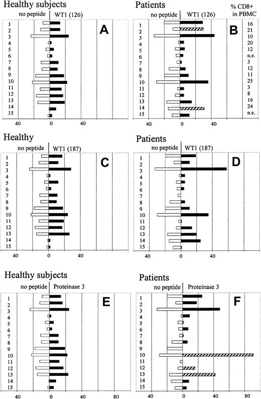 Fig. 1. T-cell responses to WT1 and proteinase 3 can be detected by ELISPOT assay. / Unstimulated PBMCs were analyzed for recognition of specific epitopes WT1 126-134 (A), WT1 187-194 (B), and proteinase 3 (C) by IFN-γ ELISPOT assay in 15 HLA-A2+ healthy subjects and in 15 AML patients. Values are expressed as number of spots per 106 PBMCs (white bars, number of spots in unstimulated PBMCs; black/striped bars, number of spots in response to peptide). Responses, which exceeded 2-fold or more the number of spots in unstimulated PBMCs and had a minimum of 10 peptide-specific spots in 106 PBMCs (after subtracting the number of spots in unstimulated PBMCs) were considered peptide specific and were shown as striped bars. The proportion of CD3 CD8 T cells in whole PBMCs, as determined by flow cytometry analyses, is indicated in AML patients (B).