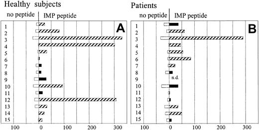 Fig. 5. T-cell responses against influenza matrix protein epitope 56-64 in AML patients and healthy subjects. / Unstimulated PBMCs were analyzed for the recognition of influenza matrix protein 58-66 peptide by IFN-γ ELISPOT assay in 14 HLA-A2+ AML patients and 15 HLA-A2+ healthy subjects. Values are expressed as number of spots per 106 PBMC (white bars number of spots in unstimulated PBMCs; black/striped bars number of spots in response to peptide). Responses, which exceeded the number of spots in unstimulated PBMCs by 2-fold or more and had a minimum of 10 peptide-specific spots in 106 PBMCs (after subtracting the number of spots in unstimulated PBMCs) were considered peptide specific and are shown as striped bars.