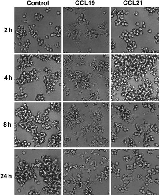 Fig. 4. Time course of mature DC morphology in the absence or presence of CCL19 or CCL21. / BC1 cells were activated by LPS and used as mature DCs. The matures DC were treated with CCL19 or CCL21 for 2 to 24 hours, and the morphologic changes were analyzed by invert microscopy (original magnification × 20). The results are representative of 3 independent experiments.