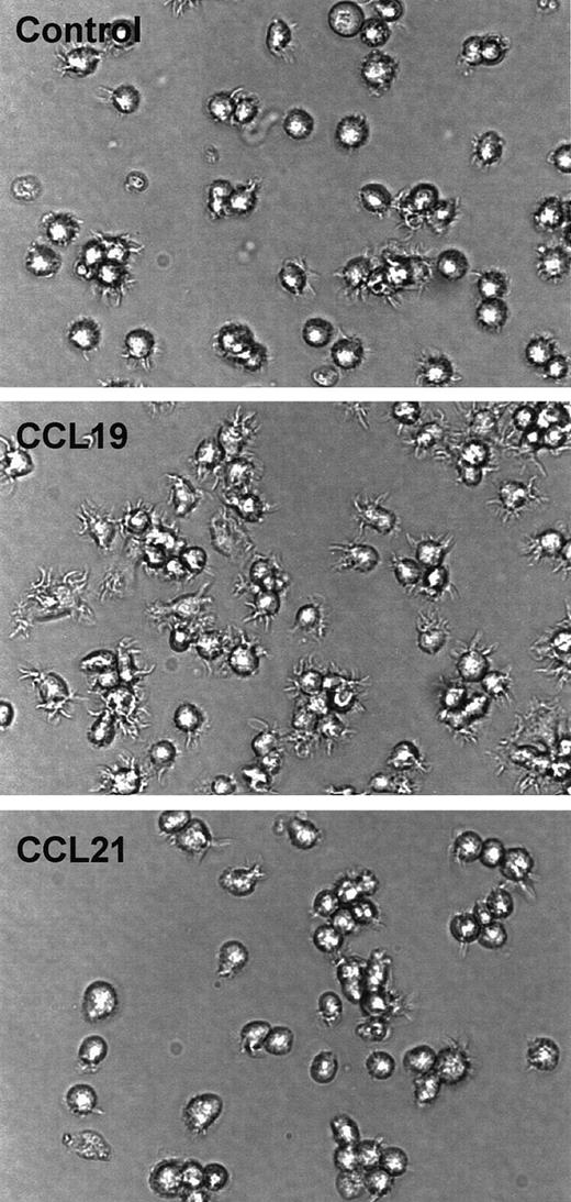 Fig. 8. Assessment of CCL19-induced dendritic extension in SPDCs. / The SPDCs were generated by culturing splenocytes with GM-CSF and fibroblast supernatant for 14 days. SPDCs were activated by LPS and used as mature SPDCs. The mature SPDCs were incubated with CCL19 (20 ng/mL) or CCL21 (100 ng/mL) for 90 minutes. The morphologic changes were analyzed by invert microscopy (original magnification × 30). The results are representative of 4 independent experiments.