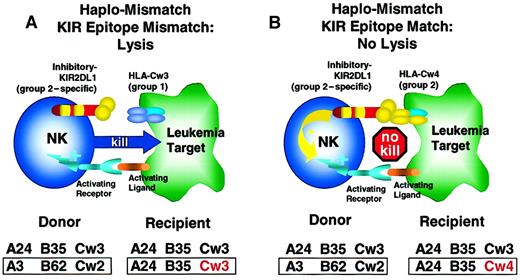 Fig. 4. KIR-epitope mismatch in haplotype-mismatched stem cell transplantation. / (A) In this example, donor and recipient are HLA haplotype–mismatched and are KIR-epitope mismatched at the HLA-C locus. The donor NK cell clones expressing KIR2DL1 recognize and are inhibited by an epitope shared by the group 2 HLA-C alleles (HLA-Cw2, 4, 5, and 6). The recipient's leukemic blasts express HLA-Cw3, a member of the group 1 HLA-C alleles, and are, therefore, not recognized by the donor's KIR2DL1, and activation of donor NK cell occurs with leukemic cell lysis. (B) Here, donor and recipient are haplotype-mismatched, but express HLA-C alleles of the same supertype group 2 (HLA-Cw2, 4, 5, and 6). Therefore, donor NK cell clones expressing the inhibitory KIR2DL1 recognize a “self-epitope” (HLA-Cw4) on the recipient's cells with inhibition of lysis of leukemic blasts. KIR epitope mismatching exerts another level of graft alloreactivity and a potent GVL effect.122