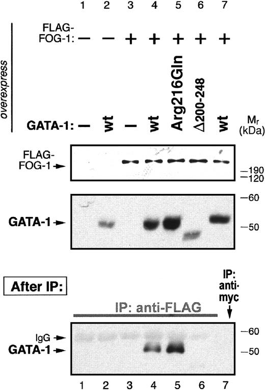 Fig. 2. Arg216Gln GATA-1, like wild-type GATA-1, binds to FOG-1. / A FLAG-tagged FOG-1 expression construct was cotransfected with various GATA-1 expression constructs into COS cells as indicated. Western blots (top panels) confirm expression from FOG and GATA constructs. (bottom panel) After immunoprecipitation (IP) with anti-FLAG antibody (or anti-myc control antibody), Western blot detection of precipitated GATA-1 shows that Arg216Gln GATA-1 (lane 5), like wild-type GATA-1, binds to FOG-1 (lane 4), whereas Δ200 to 248 GATA-1 (N finger–deleted; lane 6) do not. No immunoprecipitation of GATA-1 is observed in control experiments (remaining lanes).