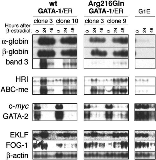 Fig. 5. Changes in gene expression following activation of wild-type or Arg216Gln G1E-ER2 by β-estradiol. / Two clones of wild-type or Arg216Gln G1E-ER2 cells were induced with β-estradiol, and transcripts of erythroid genes were assayed by Northern blotting. Like wild-type G1E-ER2 clones, Arg216Gln G1E-ER2 clones showed changes in erythroid gene expression. However, in some instances (eg, the erythroid anion transporter band 3; see “Results” for details), the level of induction was reduced relative to wild-type controls. Parental G1E cells, which lack GATA-1, do not display changes in expression of these markers following β-estradiol induction.