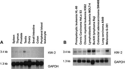 Fig. 2. Northern blot analysis of gene expression for the antigen KW-2 and GAPDH. / Normal tissue (A) and tumor tissue (B).