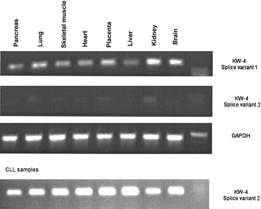 Fig. 3. Tissue expression of different splice variants of KW-4 by RT-PCR. / RT-PCR with splice variant–specific primers for KW-4: several normal tissues as well as 8 different CLL samples are shown.