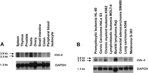 Fig. 4. Northern blot analysis of gene expression for the antigen KW-4 and GAPDH. / Normal tissue (A) and tumor tissue (B).