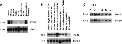 Fig. 5. Northern blot analysis of gene expression for the antigen KW-13 and GAPDH. / Normal tissue (A), tumor tissue (B), and CLL cells (C).