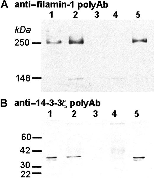 Fig. 6. Coimmunoprecipitation of the interleukin-4Rα/GP Ibα subunit, filamin-1, and 14-3-3ζ. / The ability of the IL-4Rα/GP Ibα subunit to interact with other cytoplasmic proteins was investigated by immunoprecipitation. The immunopurified products were electrophoresed and analyzed by Western blotting using antibodies that recognize filamin-1 (A) or 14-3-3ζ (B). Shown is the resulting autoradiograph produced by the immunoreactive species. Lane 1, normal (wild-type) mouse platelet lysate (no immunoprecipitation); lane 2, immunoprecipiated platelet lysate from animals devoid of mouse GP Ibα but expressing the IL-4Rα transgene (Tg33; GP Ibαnull); lane 3, same lystate as lane 2 but immunoprecipitated with a control IgG; lane 4, normal (wild-type) mouse platelet lysate immunoprecipitated with the anti–IL-4R mAb; lane 5, normal human platelet lysate (no immunoprecipitation).