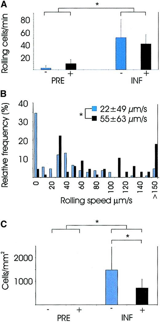 Fig. 1. Video analysis of leukocytes at the site of inflammation. / PRE indicates analysis performed before surgery, and INF indicates analysis 24 hours after surgery when the inflammatory reaction was most vivid. Patients without hydrocortisone treatment are marked with blue bars and patients with hydrocortisone treatment with black. Pvalues between the groups were calculated with Mann-WhitneyU test. *P <.05. (A) Number of rolling cells in conjunctival venules was significantly higher in specimens taken during inflammation than in specimens taken before inflammation (groups pooled in the Figure), and hydrocortisone had no effect on this variable. (B) Relative frequencies of leukocyte rolling velocities in specimens taken during the inflammation, with or without preoperative hydrocortisone treatment. Leukocyte rolling in the nontreated patients was significantly slower than in the hydrocortisone-treated patients. (C) Number of extravasated leukocytes per square millimeter in conjunctival tissue. Specimens taken before the inflammation contained essentially no leukocytes, but the number was significantly elevated in the specimens taken during the inflammation versus those taken before the inflammation, and hydrocortisone treatment significantly reduced their numbers.