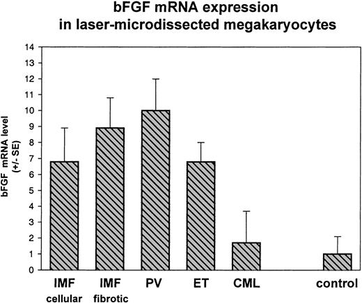 Fig. 2. bFGF expression in laser-microdissected megakaryocytes. / In microdissected megakaryocytes, overexpression of bFGF mRNA was found in PV (× 10, P < .0001), in fibrotic IMF (× 8.9,P < .001), in prefibrotic IMF (× 6.8,P < .009), and in ET (× 6.8, P < .0001), compared to control megakaryocytes. In CML, megakaryocytes exhibited moderately higher bFGF mRNA levels compared to controls without significance, but significant differences occurred in comparison to PV (P < .0001), fibrotic IMF (P < .002), and prefibrotic IMF and ET (P < .04 andP < .001, respectively). Real-time RT-PCR with bFGF forward primer 5′-CCCGGCCACTTCAAGGA; bFGF reverse primer 5′-TGGATGCGCAGGAAGAAG and bFGF probe 5′-CCCAAGCGGCTGTACTGCAAAAACG. β-Glucuronidase (β-GUS) forward primer 5′-CTCATTTGGAATTTTGCCGATT, β-GUS reverse primer 5′-AGTGAAGATCCCCTTTTTA, and β-GUS probe 5′-TGAACAGTCACCGACGAGAGTGCTGG. Transcript levels are depicted as multiples of the amount found in reactive control cases ( = 1).