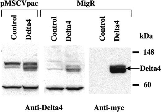 Fig. 1. Retroviral expression of Delta4 protein. / Cell extracts were prepared from NIH3T3 cells transduced with pMSCVpac, pMSCVpacDelta4, MigR, or MigRDelta4. Expression of Delta4 was detected by Western blot analysis with polyclonal anti-Delta4 antibodies in cells transduced with Delta4-carrying virus but not control virus. Delta4 in MigR was fused to a C-terminal myc tag and could also be detected with anti-myc monoclonal antibodies (mAbs).