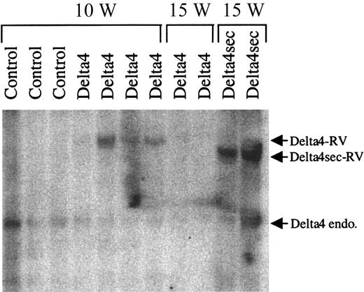 Fig. 5. Decrease of Delta4-transduced spleen cells in late-stage disease. / Spleens were harvested 10 (10 W) and 15 (15 W) weeks after transplantation from animals transduced with control virus or viruses carrying either full-length (Delta4) or secreted Delta4 (Delta4sec). Southern blot analysis for proviral integration was generated from genomic DNA digested with XbaI. A cDNA fragment corresponding to the extracellular domain of Delta4 was used as a probe. XbaI cuts in the retroviral LTR and releases a 4.75-kb fragment for full-length Delta4 and a 4.25-kb fragment for secreted Delta4. The endogenous (endo) and retroviral (RT) Delta4 bands are indicated.